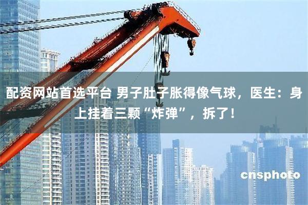 配资网站首选平台 男子肚子胀得像气球,医生:身上挂着三颗“炸弹”,拆了!